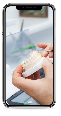 Mobile phone displaying dental procedure 2